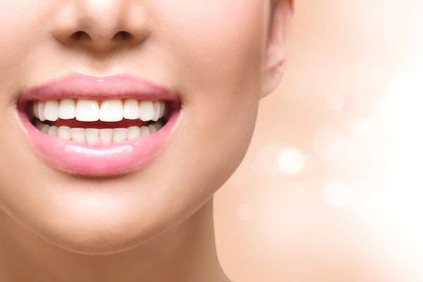 Teeth Reshaping: Enhance Your Smile with Dental Contouring « Smile Team  Orthodontics